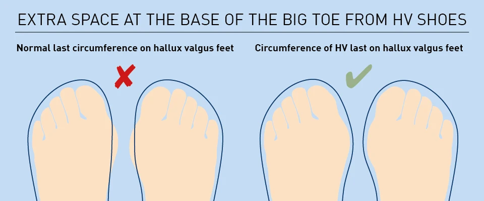 Shoes for bunions