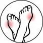 picto hallux valgus